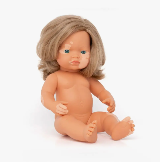 Baby Doll Caucasian Girl with Vitiligo 15in