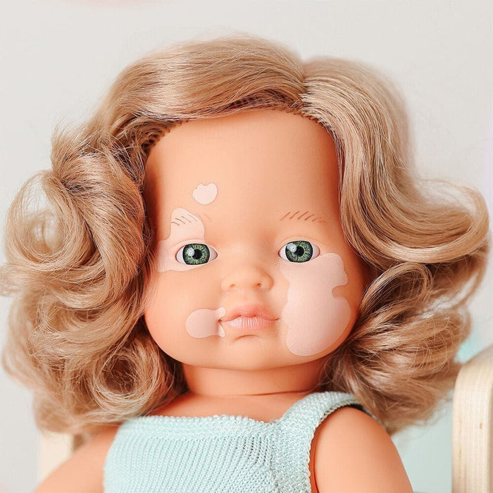 Baby Doll Caucasian Girl with Vitiligo 15in