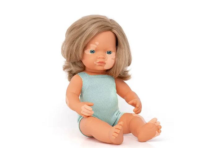 Baby Doll Caucasian Girl with Vitiligo 15in